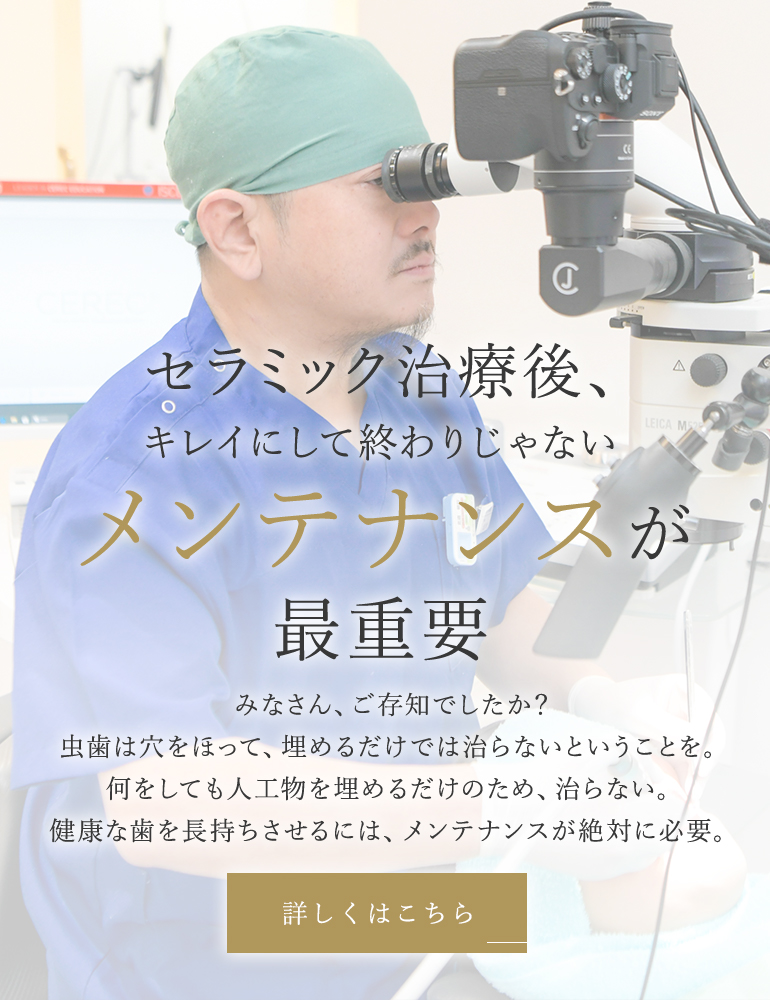 セラミック治療後、キレイにして終わりじゃない メンテナンスが最重要